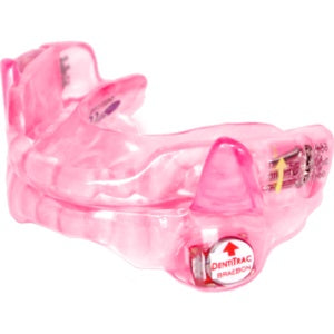 Oral Appliance for Sleep Apnea